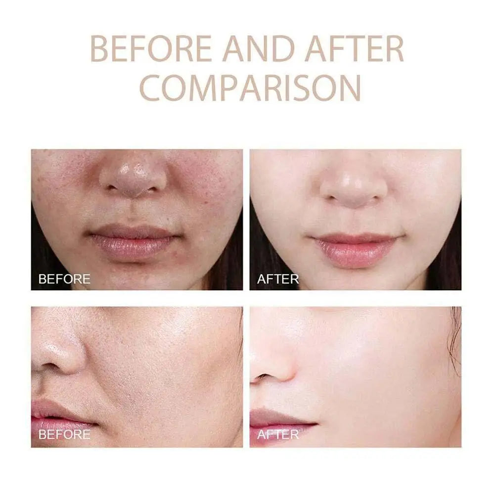 Dr. Melaxin Rice Exfoliating Serum Facial Moisturizing Soften Serum Blackhead Removal Hydrating Pore Shrinking Korean Skin Care